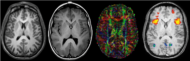 Figure 4 for Automated computed tomography and magnetic resonance imaging segmentation using deep learning: a beginner's guide
