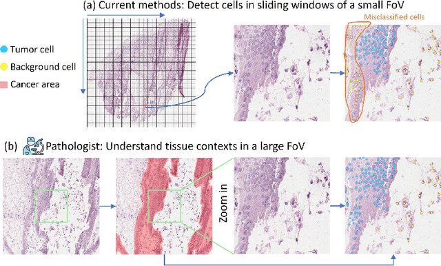 Figure 1 for Towards Effective and Efficient Context-aware Nucleus Detection in Histopathology Whole Slide Images