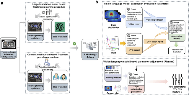 Figure 1 for Automated radiotherapy treatment planning guided by GPT-4Vision