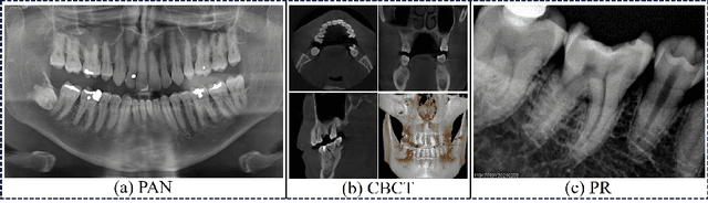 Figure 1 for PRAD: Periapical Radiograph Analysis Dataset and Benchmark Model Development