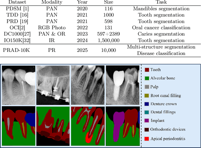 Figure 2 for PRAD: Periapical Radiograph Analysis Dataset and Benchmark Model Development