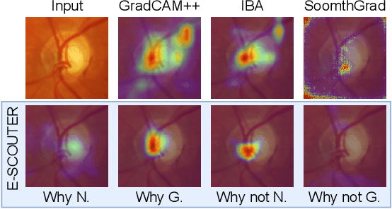 Figure 3 for Explainable Image Recognition via Enhanced Slot-attention Based Classifier