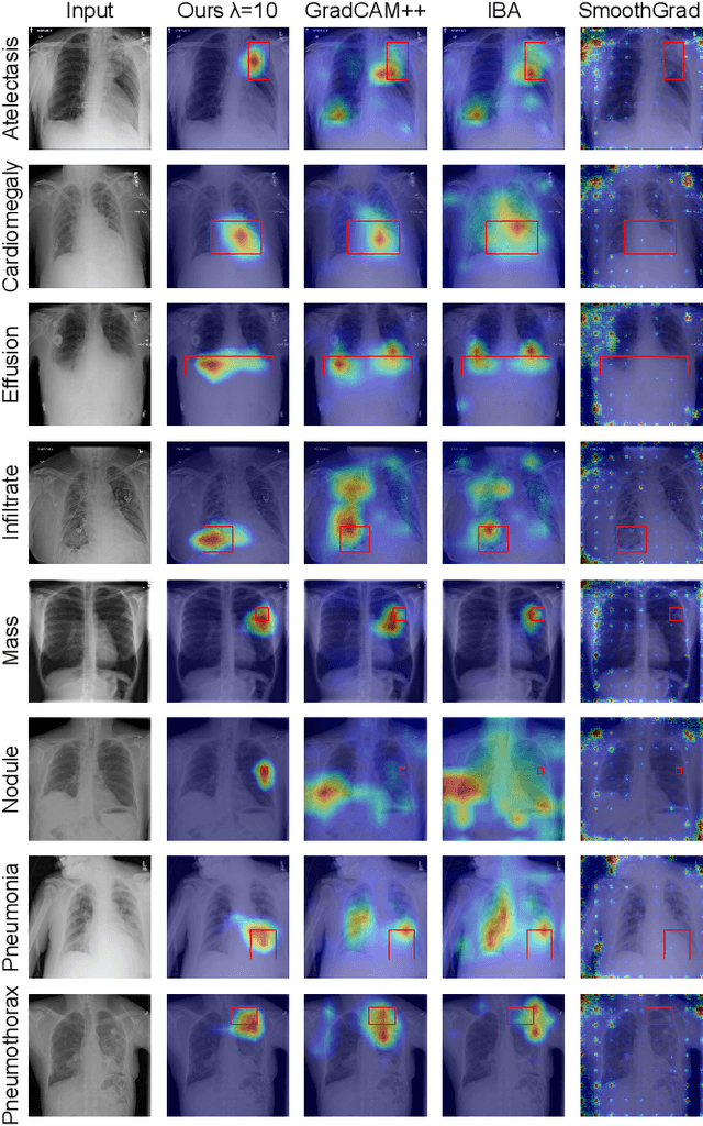Figure 4 for Explainable Image Recognition via Enhanced Slot-attention Based Classifier