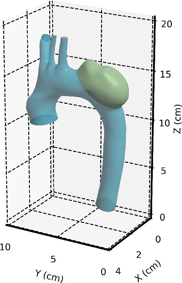 Figure 1 for Mesh-Informed Reduced Order Models for Aneurysm Rupture Risk Prediction
