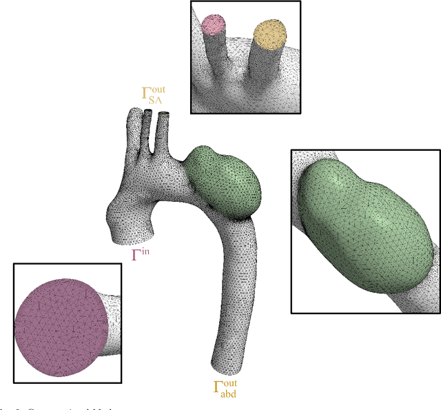 Figure 3 for Mesh-Informed Reduced Order Models for Aneurysm Rupture Risk Prediction