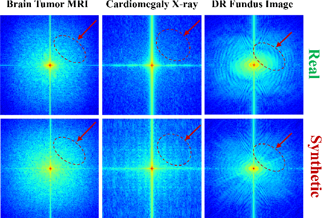 Figure 1 for Rethinking Bias in Generative Data Augmentation for Medical AI: a Frequency Recalibration Method