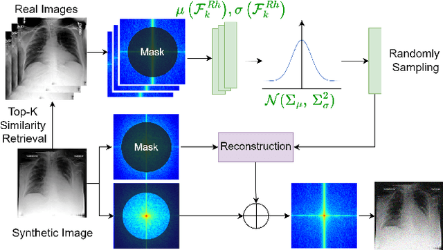 Figure 3 for Rethinking Bias in Generative Data Augmentation for Medical AI: a Frequency Recalibration Method