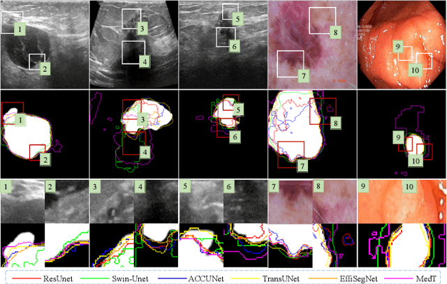 Figure 1 for MAMBO-NET: Multi-Causal Aware Modeling Backdoor-Intervention Optimization for Medical Image Segmentation Network