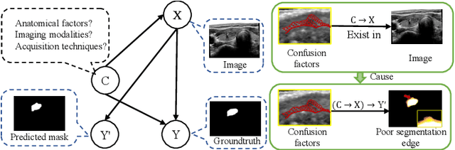 Figure 4 for MAMBO-NET: Multi-Causal Aware Modeling Backdoor-Intervention Optimization for Medical Image Segmentation Network