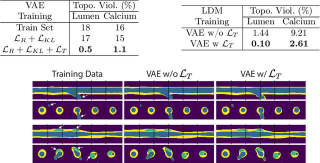 Figure 2 for A Diffusion Model for Simulation Ready Coronary Anatomy with Morpho-skeletal Control