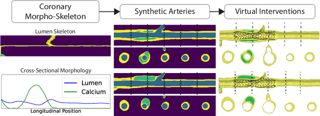 Figure 1 for A Diffusion Model for Simulation Ready Coronary Anatomy with Morpho-skeletal Control