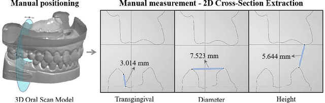 Figure 1 for SSA3D: Text-Conditioned Assisted Self-Supervised Framework for Automatic Dental Abutment Design