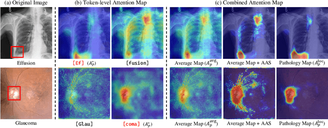Figure 3 for Pathology-Aware Adaptive Watermarking for Text-Driven Medical Image Synthesis