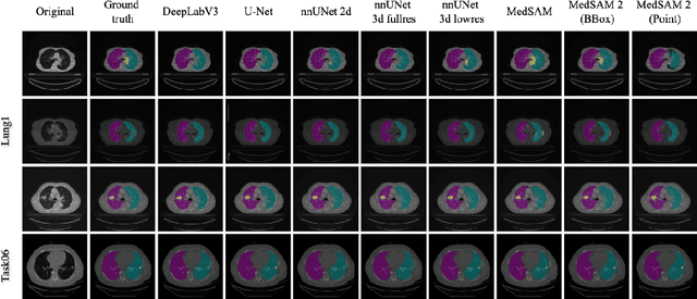 Figure 1 for Can Foundation Models Really Segment Tumors? A Benchmarking Odyssey in Lung CT Imaging