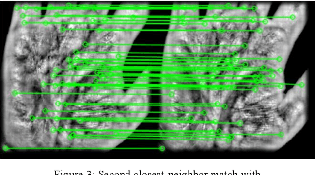 Figure 4 for Robust Palm-Vein Recognition Using the MMD Filter: Improving SIFT-Based Feature Matching