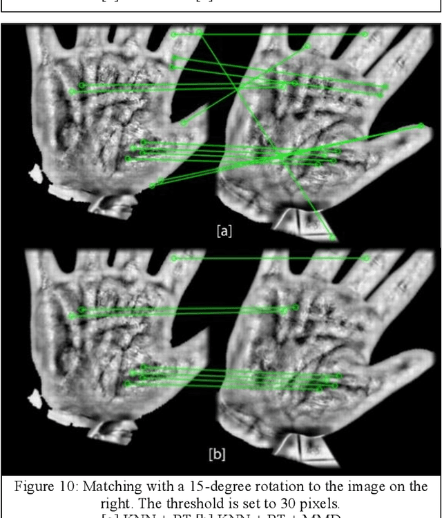 Figure 2 for Robust Palm-Vein Recognition Using the MMD Filter: Improving SIFT-Based Feature Matching
