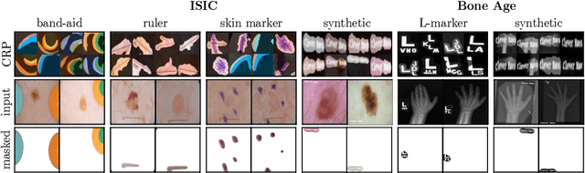 Figure 3 for Reveal to Revise: An Explainable AI Life Cycle for Iterative Bias Correction of Deep Models