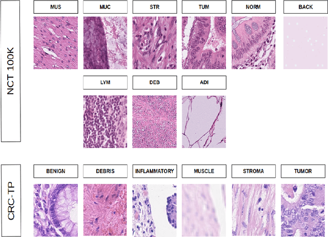 Figure 3 for Cross-Domain Evaluation of Few-Shot Classification Models: Natural Images vs. Histopathological Images