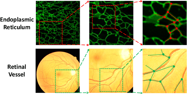 Figure 1 for Representing Topological Self-Similarity Using Fractal Feature Maps for Accurate Segmentation of Tubular Structures