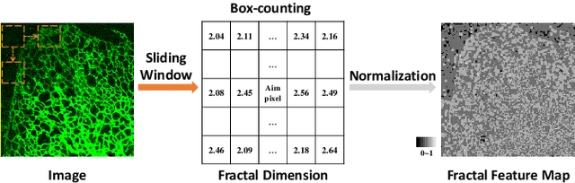 Figure 3 for Representing Topological Self-Similarity Using Fractal Feature Maps for Accurate Segmentation of Tubular Structures