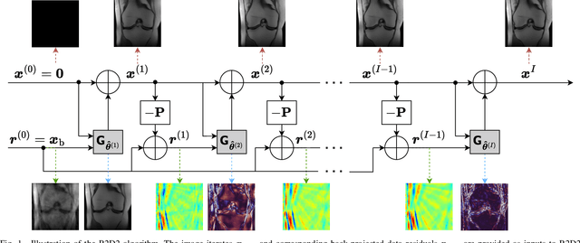 Figure 1 for The R2D2 Deep Neural Network Series for Scalable Non-Cartesian Magnetic Resonance Imaging
