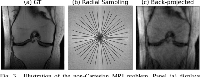 Figure 4 for The R2D2 Deep Neural Network Series for Scalable Non-Cartesian Magnetic Resonance Imaging