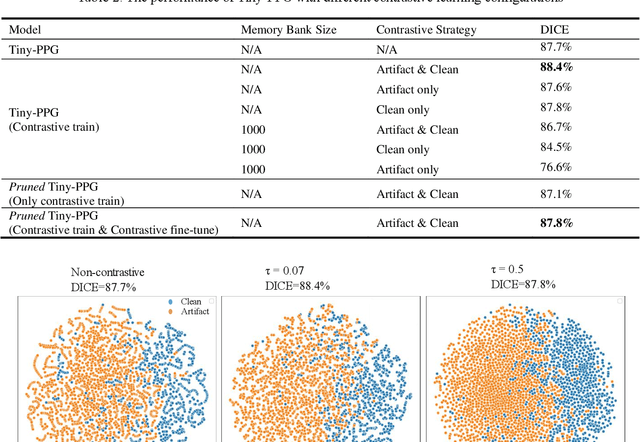 Figure 4 for Tiny-PPG: A Lightweight Deep Neural Network for Real-Time Detection of Motion Artifacts in Photoplethysmogram Signals on Edge Devices