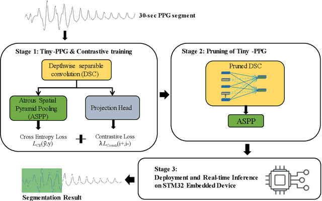 Figure 1 for Tiny-PPG: A Lightweight Deep Neural Network for Real-Time Detection of Motion Artifacts in Photoplethysmogram Signals on Edge Devices