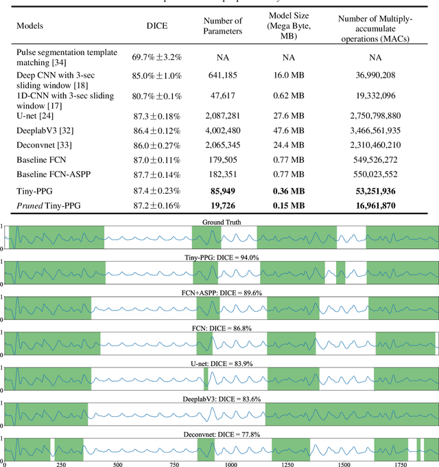 Figure 2 for Tiny-PPG: A Lightweight Deep Neural Network for Real-Time Detection of Motion Artifacts in Photoplethysmogram Signals on Edge Devices