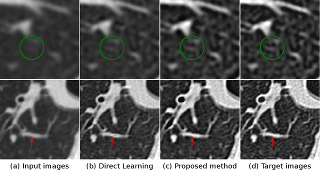 Figure 4 for Display Field-Of-View Agnostic Robust CT Kernel Synthesis Using Model-Based Deep Learning