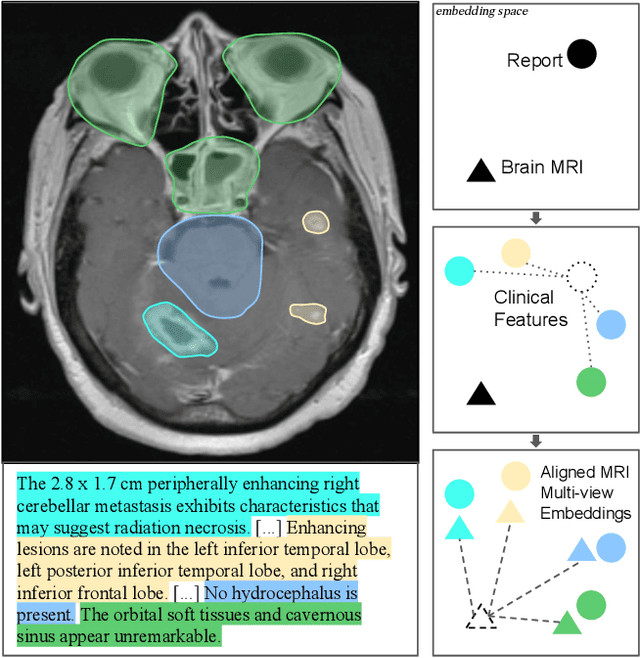 Figure 1 for brat: Aligned Multi-View Embeddings for Brain MRI Analysis