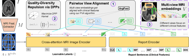 Figure 3 for brat: Aligned Multi-View Embeddings for Brain MRI Analysis