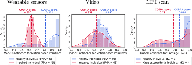 Figure 3 for Quantifying Impairment and Disease Severity Using AI Models Trained on Healthy Subjects