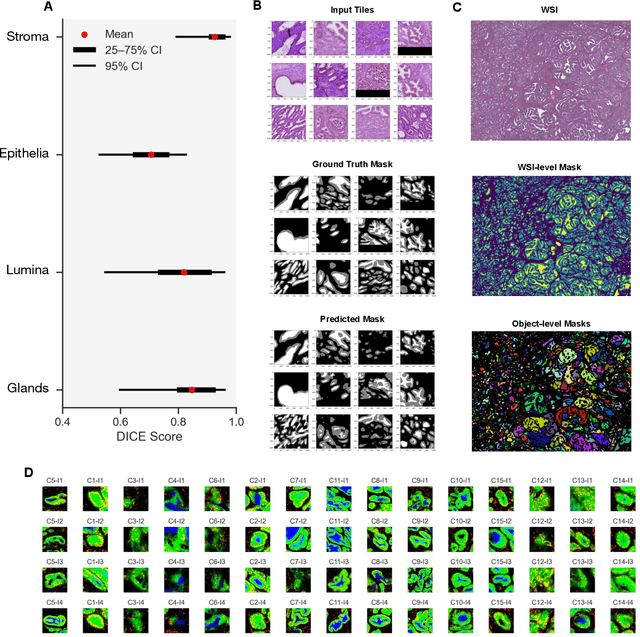 Figure 2 for Histology-informed tiling of whole tissue sections improves the interpretability and predictability of cancer relapse and genetic alterations