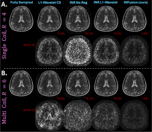 Figure 3 for INFusion: Diffusion Regularized Implicit Neural Representations for 2D and 3D accelerated MRI reconstruction