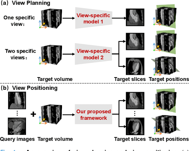 Figure 1 for AVP-AP: Self-supervised Automatic View Positioning in 3D cardiac CT via Atlas Prompting