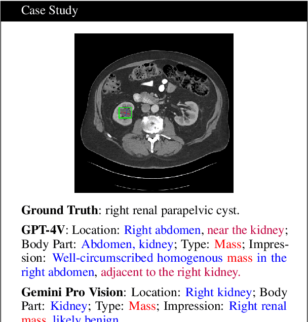 Figure 3 for Decomposing Vision-based LLM Predictions for Auto-Evaluation with GPT-4