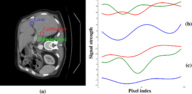 Figure 1 for Learning Multi-axis Representation in Frequency Domain for Medical Image Segmentation