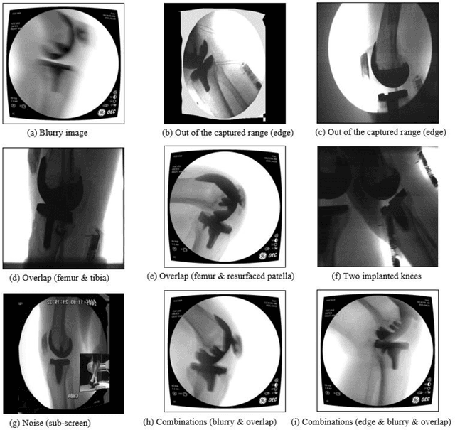 Figure 4 for An Automated Real-Time Approach for Image Processing and Segmentation of Fluoroscopic Images and Videos Using a Single Deep Learning Network