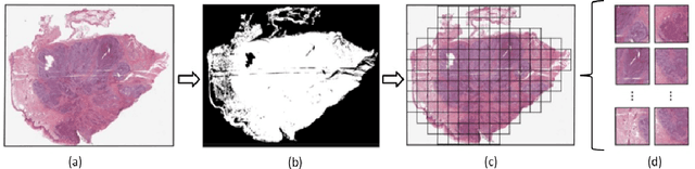 Figure 2 for Clustered Patch Embeddings for Permutation-Invariant Classification of Whole Slide Images