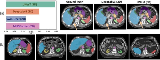 Figure 1 for Enhancing Single-Slice Segmentation with 3D-to-2D Unpaired Scan Distillation