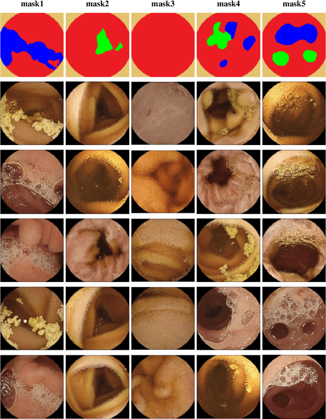 Figure 2 for Semantic Map Guided Synthesis of Wireless Capsule Endoscopy Images using Diffusion Models