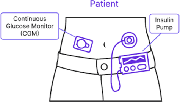 Figure 1 for Optimizing the Design of an Artificial Pancreas to Improve Diabetes Management