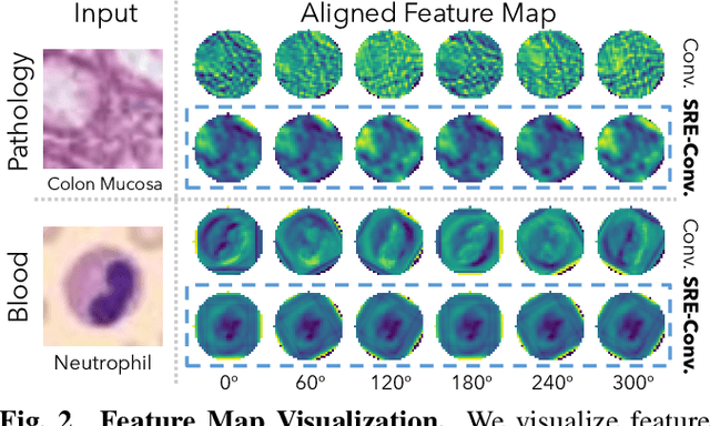 Figure 4 for SRE-Conv: Symmetric Rotation Equivariant Convolution for Biomedical Image Classification