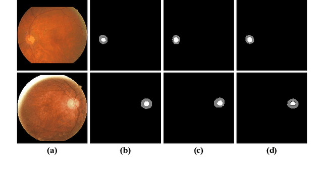 Figure 3 for Clean Label Disentangling for Medical Image Segmentation with Noisy Labels