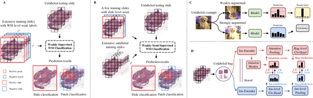Figure 1 for Weakly Semi-supervised Whole Slide Image Classification by Two-level Cross Consistency Supervision