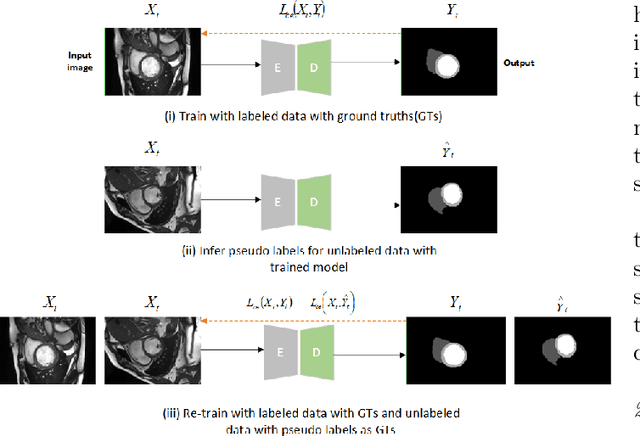 Figure 1 for Self-training with dual uncertainty for semi-supervised medical image segmentation
