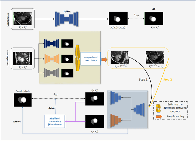 Figure 3 for Self-training with dual uncertainty for semi-supervised medical image segmentation