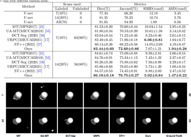 Figure 2 for Self-training with dual uncertainty for semi-supervised medical image segmentation