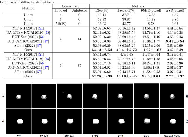 Figure 4 for Self-training with dual uncertainty for semi-supervised medical image segmentation
